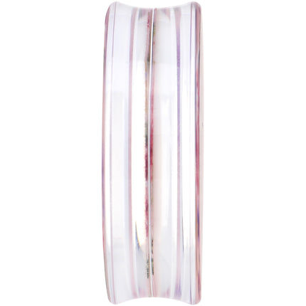 40mm Acrylic Pink Grandma's Wallpaper Flowered Saddle Plug