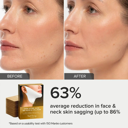 24K Gold V-Line Lifting Mask