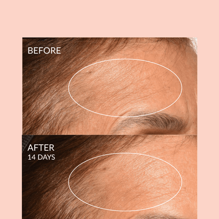 Theorem Serum Boost