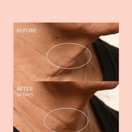 Theorem Serum Boost