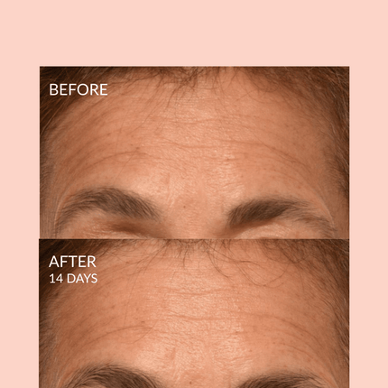 Triple Lift Molecule Mask